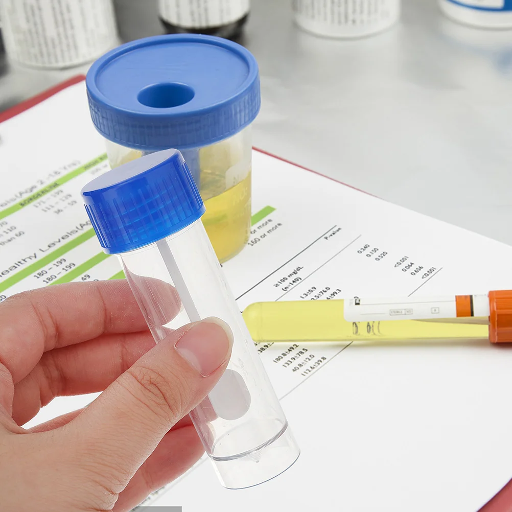 50Pcs Stool Sample Cups 25ml with Spoon Fecal Testing Containers Sampling Cups Plastic Recipients for Lab Hospital Use