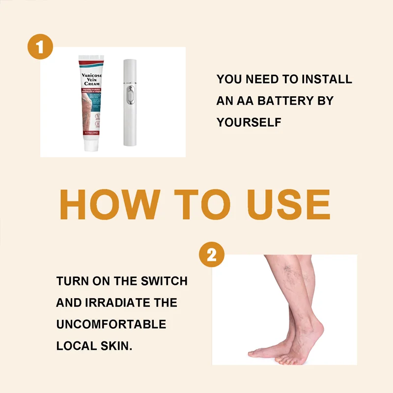 Caneta laser avançada para veias, trata varizes, reduz o inchaço das pernas, hidratação da pele