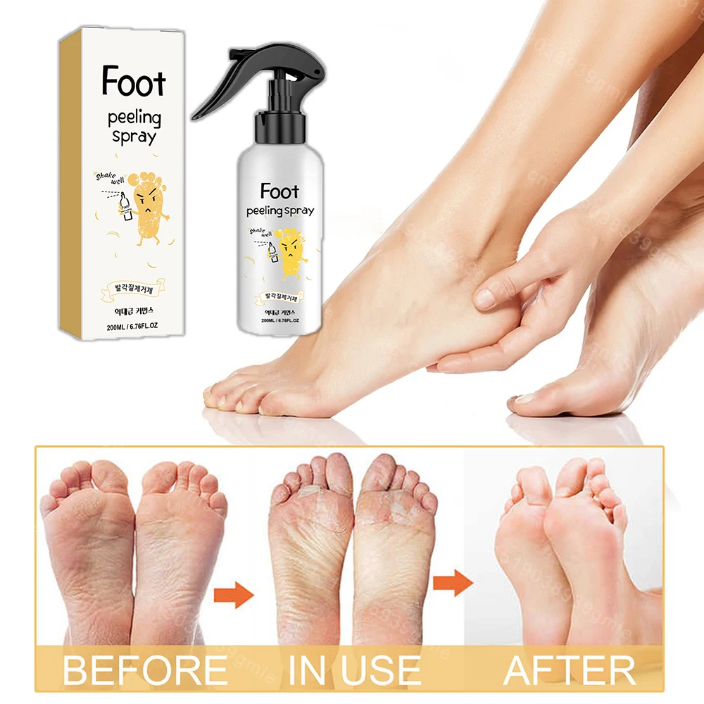 رذاذ تقشير القدم إصلاح اشراق مكافحة التجفيف تبييض قدم الرعاية إزالة السائل الجلد الميت مكافحة الكراك الجاف أداة العناية بالقدم #1