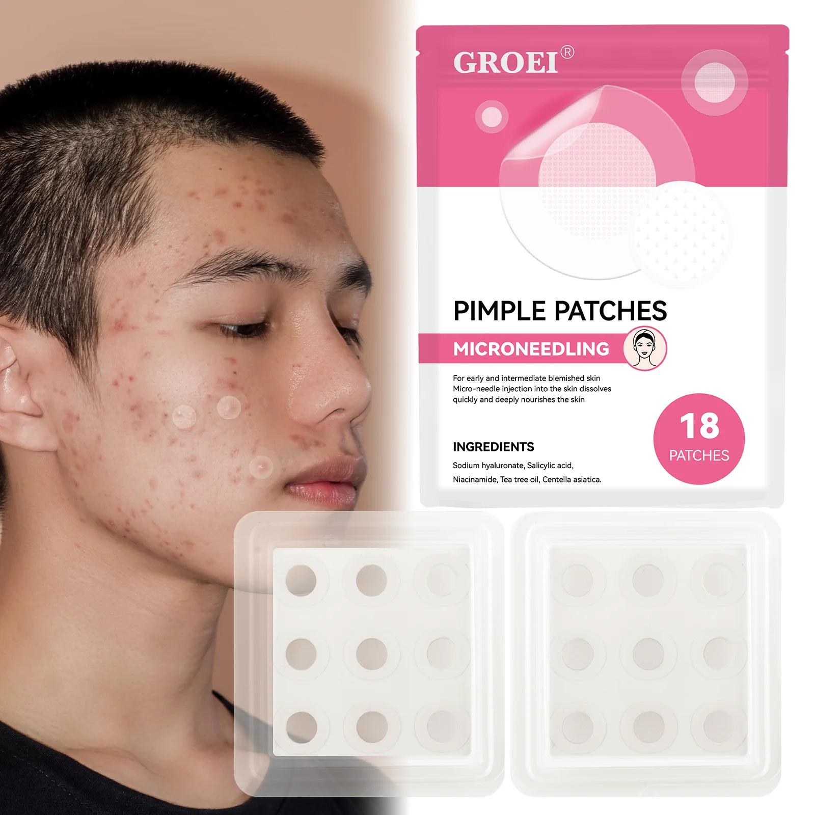 GROEI 18Pcs Microneedle Acne Patches Pimple Invisible Beauty Concealer Blemish Treatment Deep Clean Pores Overnight Recovery