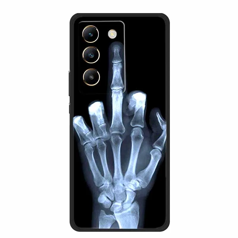 For OPPO A5 5G Gobal Case A 5 2025 Phone Cover Wolf Black Silicone Soft Back Cover Case For OPPO A5 4G 5G A5m A5i Pro Case Coque