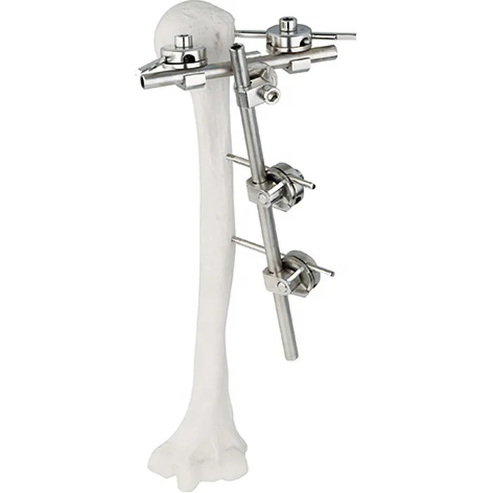 جودة مضمونة مثبت خارجي نصف دائري جراحي