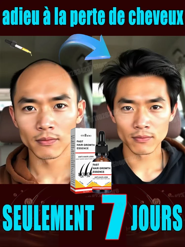 

You need a hairstyle!! Hair is getting more and more, say goodbye to baldness, hair becomes thicker, hot selling products.