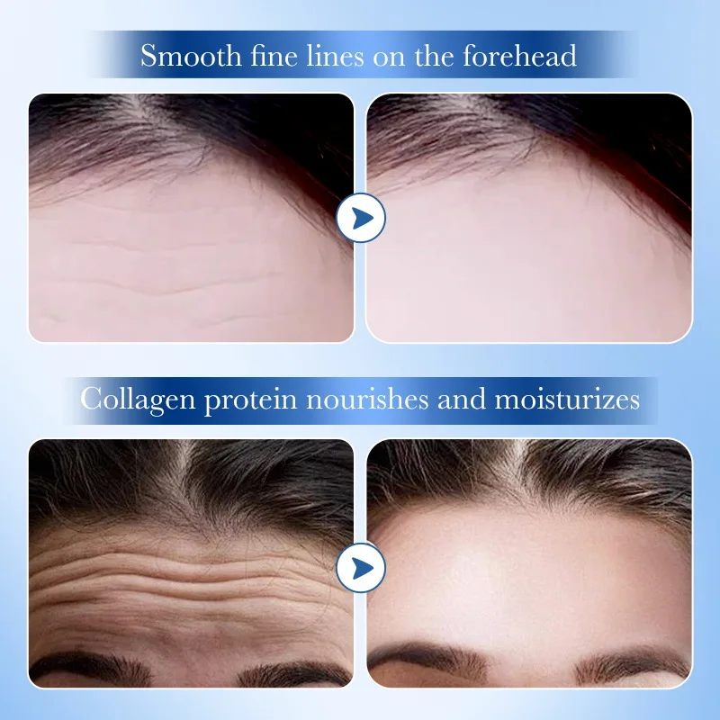 10pcs Anti-wrinkle Forehead Line Removal Gel Patch Firming Mask Frown Lines Face Skin Care Stickers Anti-aging Collagen Patch