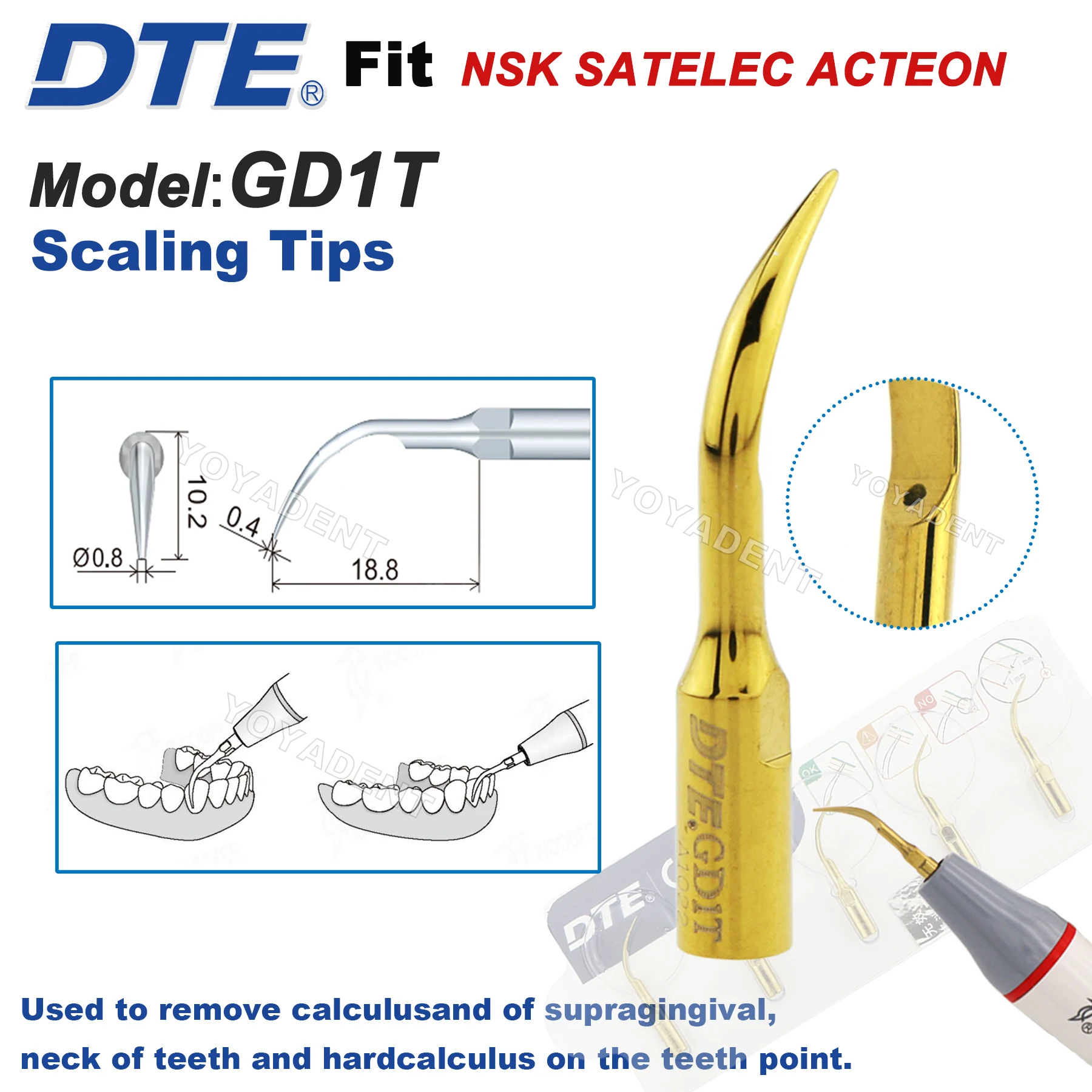

Насадки Woodpecker DTE, насадки для стоматологического ультразвукового скалера GD1T, насадка для масштабирования, подходит для NSK SATELEC, наконечник для скалера, медицинские аксессуары