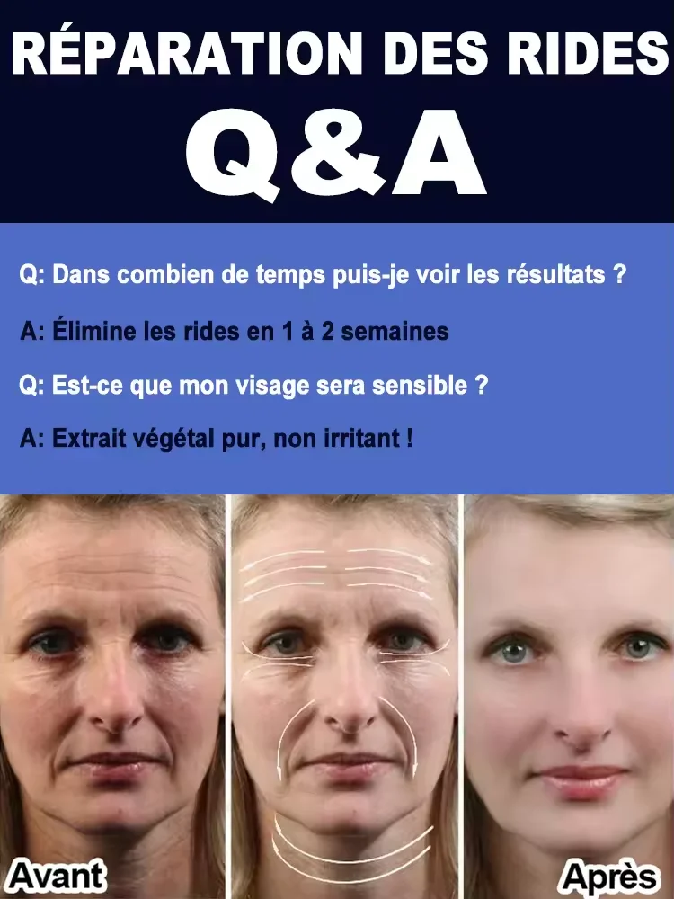 دافئ وخالي من التجاعيد في عام 2025. جلد كامل الجسم، يجلب نفسه إلى سن 18 عامًا