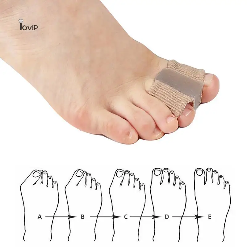 Siliconen Teen Spreider Separator Bunion Hallux Valgus Corrector Duim Vinger Correctie Stijltang Voetverzorging Tool