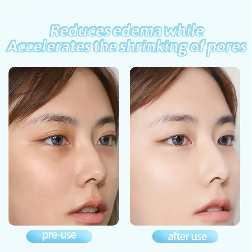 Mini ferramentas para cuidados com a pele, massagem facial para resfriamento de rolo de olhos e pescoço