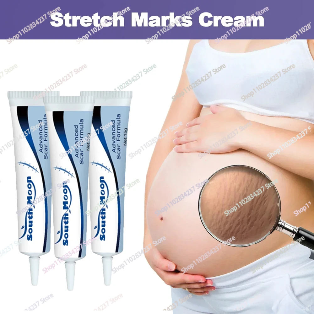 Remover Stretch Mark Permanent Stretch Mark Removerstretch marks New