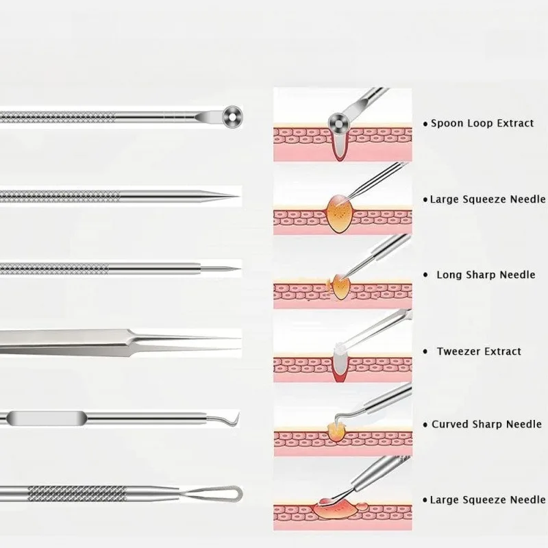 4/6Pcs/Set Acne Removal Needle Stainless Steel Clip Blackhead Removal Tool Blemishes Extractor Facial Skin Care Pore Clean Tools