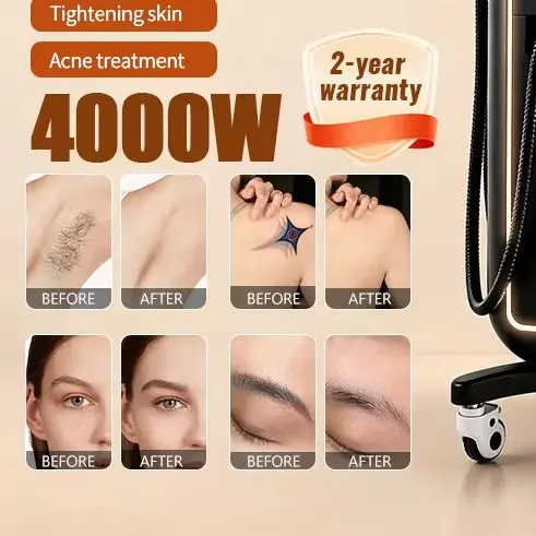 4 IN 1 4000W Beauty Machine 808nm Diode Hair Removal Picosecond Tattoo Removal IPL Skin Rejuvenation RF Skin Tightening Salon