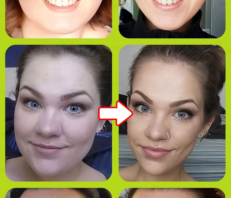 V-face Repair Mask, Eliminates double Chin, improves facial contouring, shaping bandage, quickly slims the face, removes masseter muscle, facial lifting band, anti-aging, deep hydration, creating a V-shaped face.