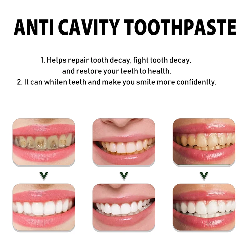 Anti-Yellow Toothpaste Deep Cleaning Tartar Decaying Fresh Breath Whitening Teeth Cleaning Toothpaste