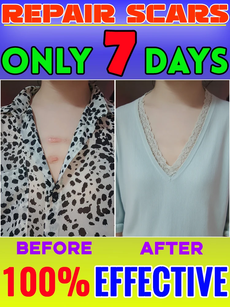 

Шрам исчезновение не мечтает