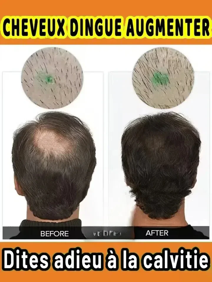 

Hᴀɪʀ ɢʀᴏᴡᴛʜ sᴇʀᴜᴍ, 99% ᴏғ ᴄᴜsᴛᴏᴍᴇʀs ᴡɪʟʟ ʀᴇᴘᴜʀᴄʜᴀsᴇ ɪᴛ ғᴏʀ ᴛʜᴇ sᴇᴄᴏɴᴅ ᴛɪᴍᴇ