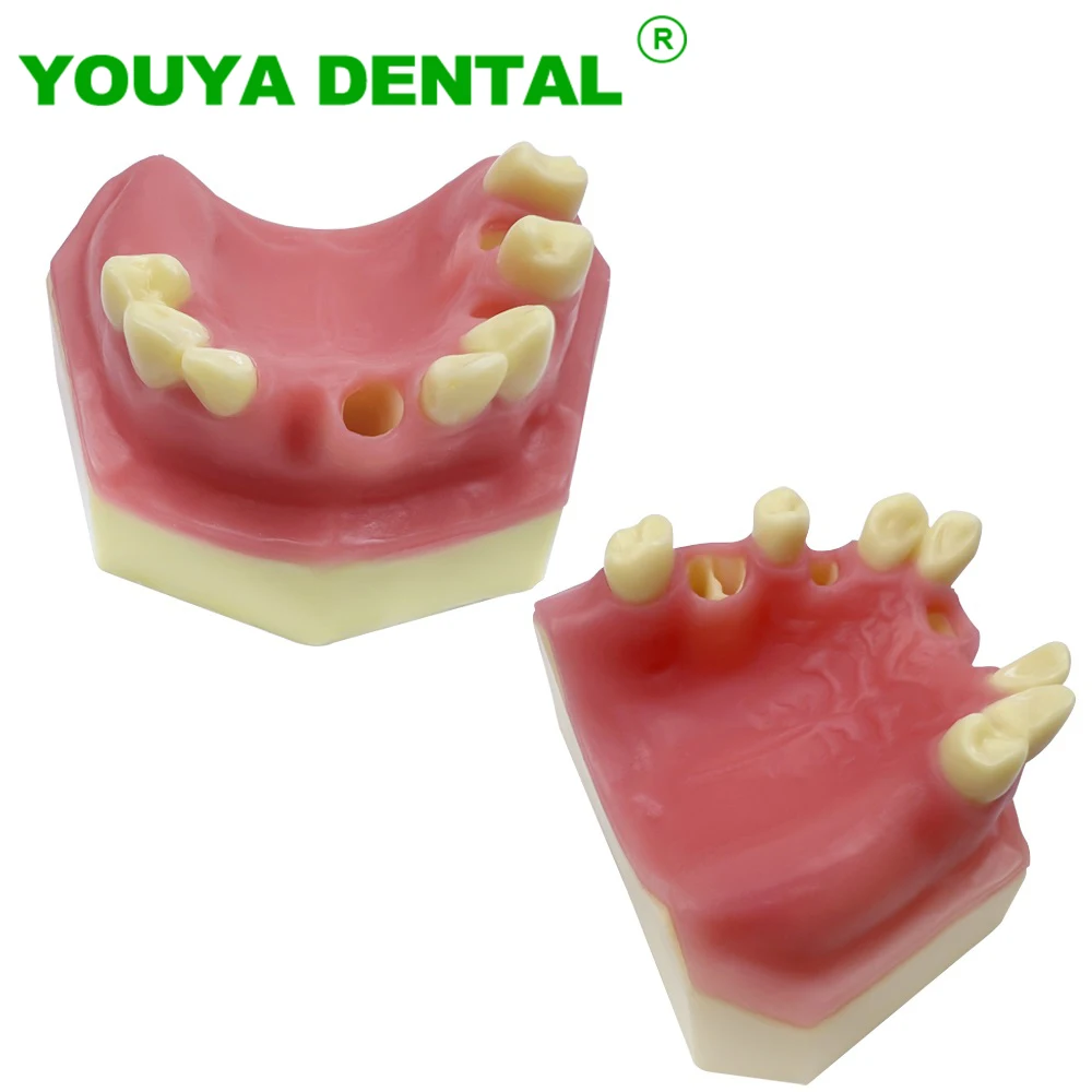 Dental Implant Model Maxillary Sinus Implantation Practice Model With Missing Teeth Dentistry Studying Teaching Training Tools