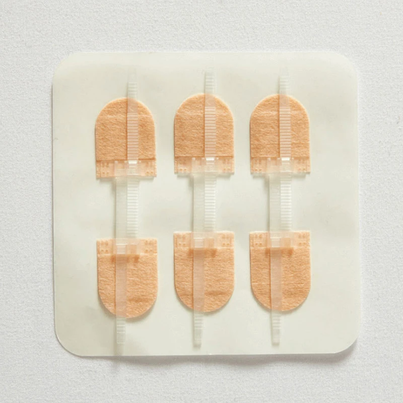 3 stks/set Rits Tie Wondsluiting Patch Hemostatische Patch Wond Snelle Hechting Rits Pleister Outdoor Draagbare