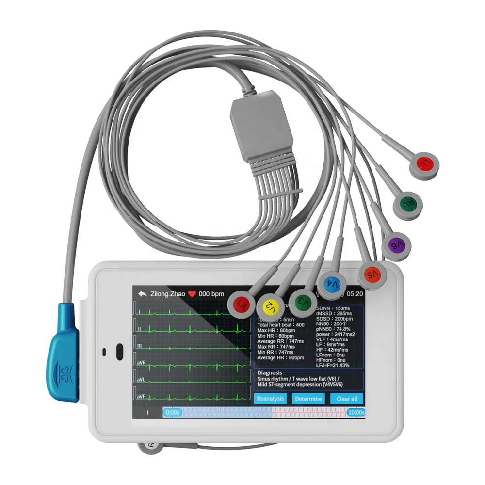 

Wellue Pcecg 500 24 Uur 12 Kanaals Draagbare Ecg Machine 12 Leads Elektrocardiograaf Monitor Ecg