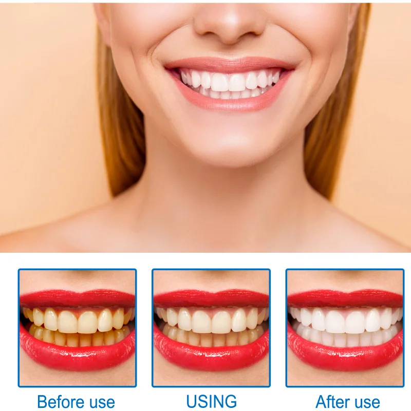 Sérum de blanchiment des dents SAF pour éliminer la plaque dentaire, haleine fraîche, hygiène buccale contre les caries dentaires, outils de livres dentaires, 2024