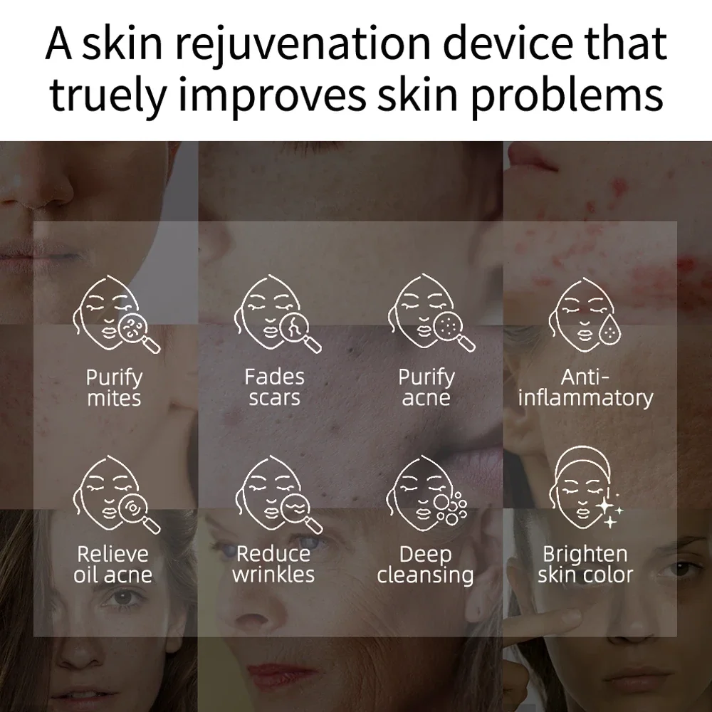 KinseiBeauty Plasma Skin Care Beauty Machine ozono Acne Remove Anti-acne sterilizzazione Skin Brightening Face massaggiatori dispositivi