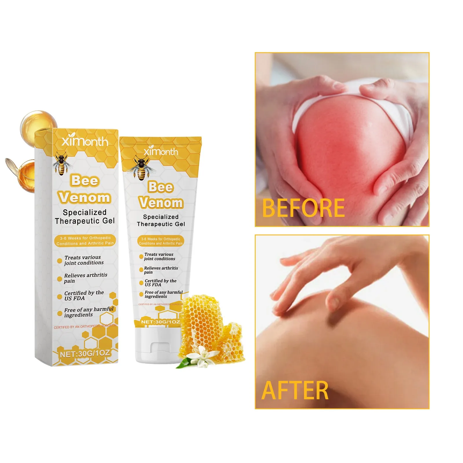 Bee Venom Bee Joint Soothing Gel Professional Treatment Gel Relieve Joint Soreness Cream Joint Soothing Ointment Body Care Gift