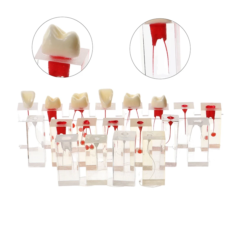 1Pcs Dental Endodontic Root Canal Model Studying Training Dentistry Education Teaching Demo Teeth Model Resin Red White Root