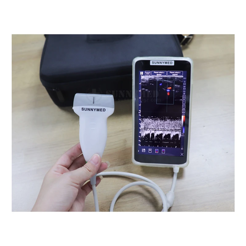 SY-AC048 Color doppler Android System 128 Elements Probe Portable Ultrasound Scanner Machine