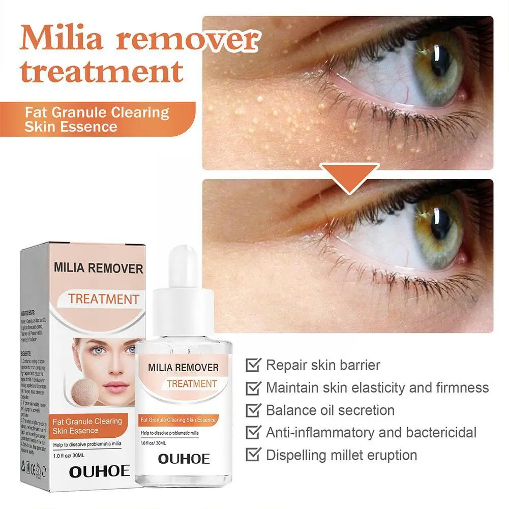 30ml Milia Remover Essence Fat Granule Skin Clearing Eye Care Serum Aging Milia Skin Repair Anti Anti Serum Essence Acne Un M0O5