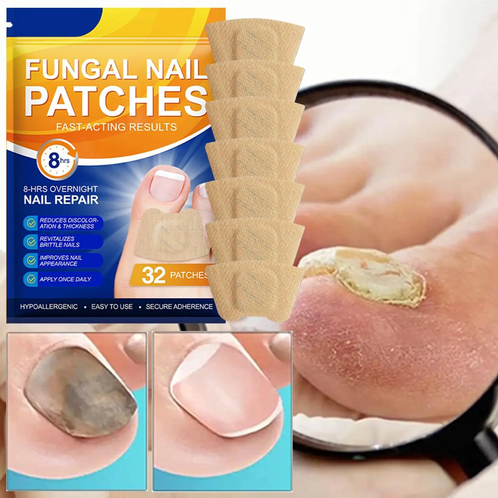 32개 네일 리페어 패치 발톱 재생 교정 스티커 손발톱 주위염 회복 페디큐어 도구 갈라진 손톱 보호 테이프