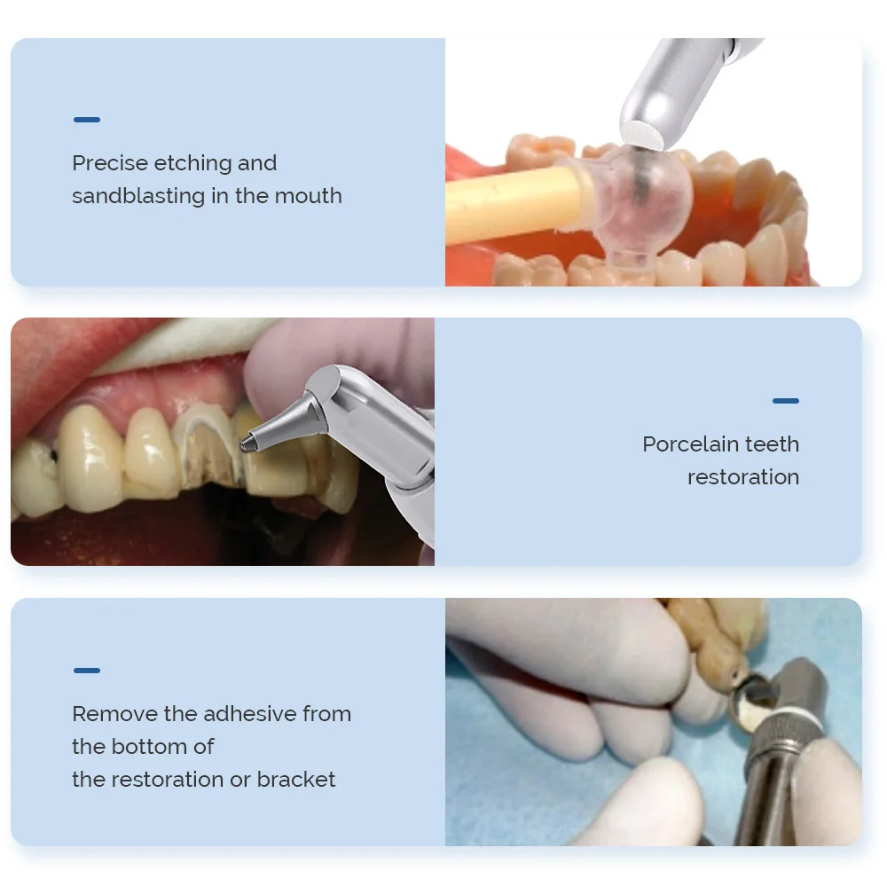 AZDENT pistola de chorro de arena de alúmina, microblaster de óxido de aluminio Dental con pulverizador de agua, pulidor de aire, equipo de dentista