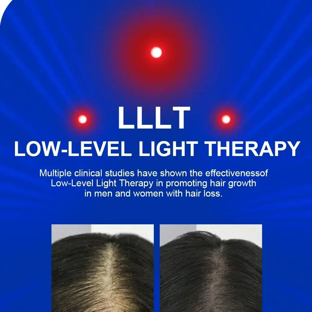 Dual Control (Remote & Manual) Laser Cap - Type-C Rechargeable, 300 Light Sources for Androgenetic Alopecia & Thinning Hair