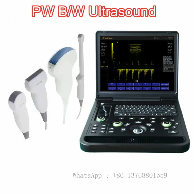 

15 Inch Large LED Screen PW ARM System Notebook Ultrasound USG Scanner Echo Machine