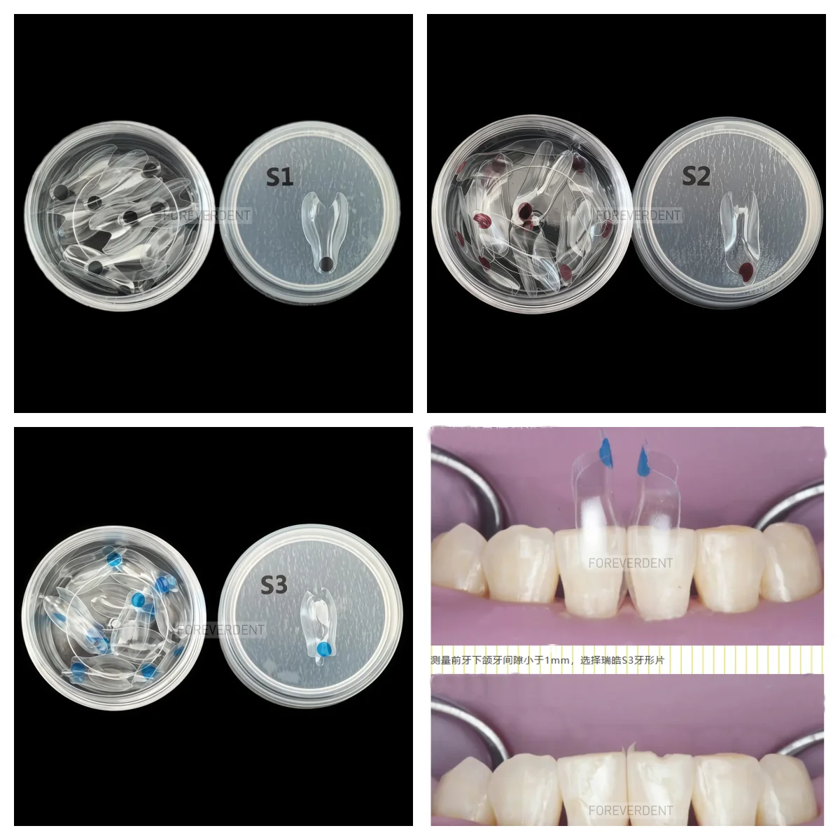 5~50pcs Dental Anterior Tranparent Clear Matrix Front Matrices Black Triangle Wedges Diastema Fits BioClear S1/S2/S3