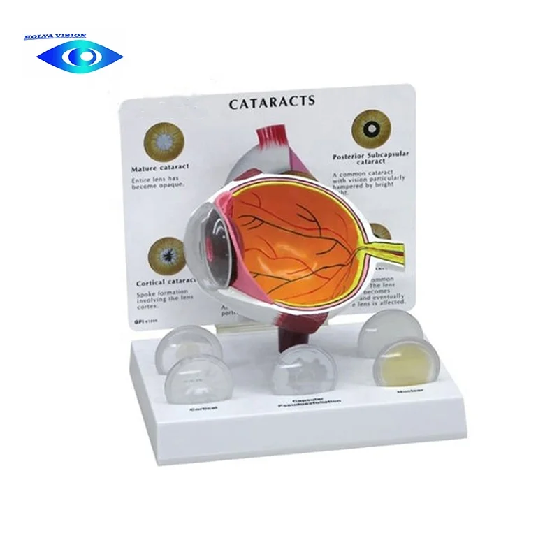 

Human Eye Cataract Model Medical Science Anatomical Eye Model