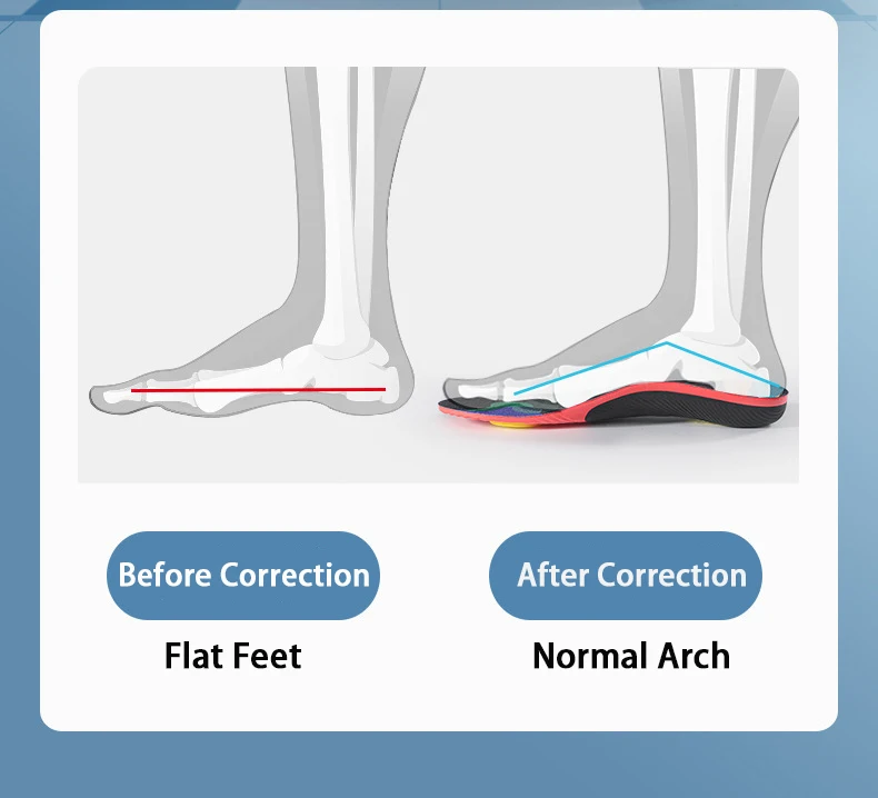 1 Pair Arch Support Plantar Fasciitis Insoles Soft Sole Shock-Absorbing Sports Shoes Insoles Flat Foot Orthopedic Insoles Unisex