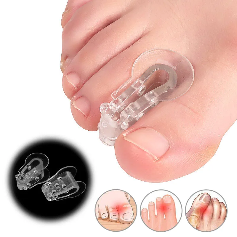 

2pcs Toe Overlapping Separator Feet Care Protector Silicone Toe Orthopedic Products Bunion Corrector Hallux Valgus Orthosis