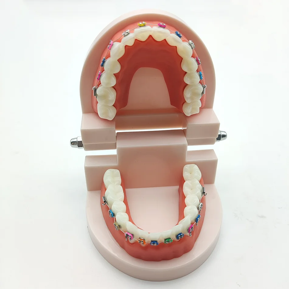 نموذج علاج تقويم الأسنان مع أورثو معدني ، قوس السيراميك ، سلك القوس ، أنبوب الشدق ، روابط الرباط ، أدوات طبيب الأسنان ، المختبر