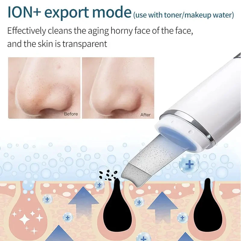 Ultrasonic Skin Vibration Facial Spatula Peeling Shovel Ion Acne Blackhead Remover Clean Cavitation For Face