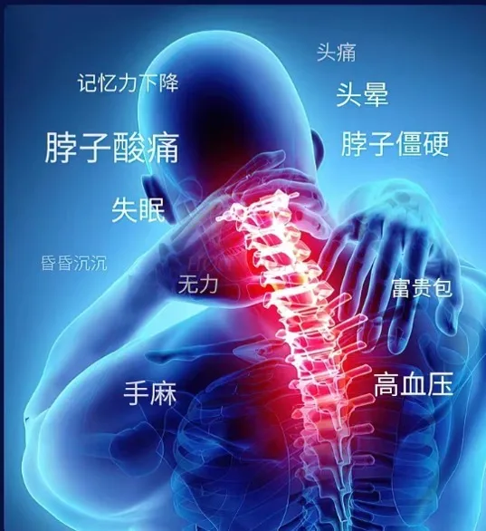 specialized pillow for neck forward tilt Correction of cervical physiological curvature straightening with reverse arch pillow