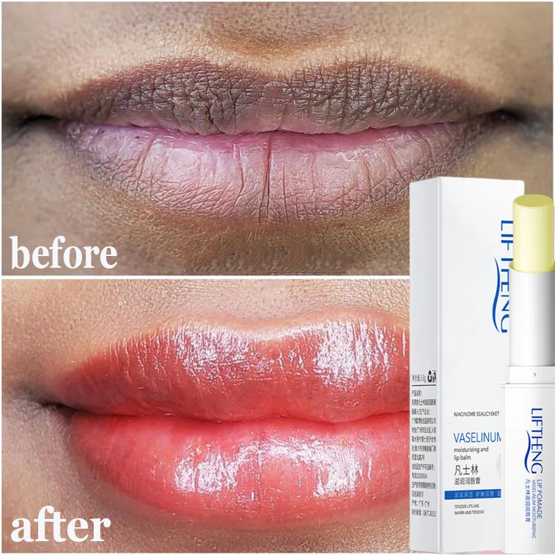 Remove Dark Smoke Lip Balm Lightening Melanin Bleaching Gloss Oil Lips Pink Lipstick Exfoliating Fade Lip Lines Korean Cosmetics
