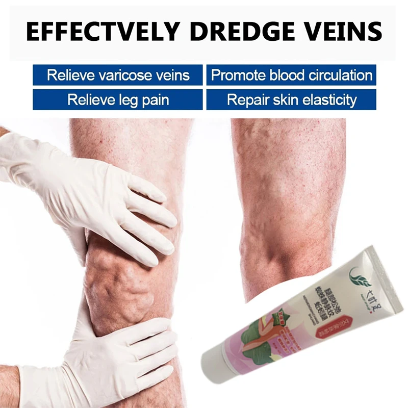 

20g Varicose Vein Repair Ointment Phlebitis Analgesics Cream Leg Bulge Spider Vein Vasculitis Pain Effective Treat Care Dressing