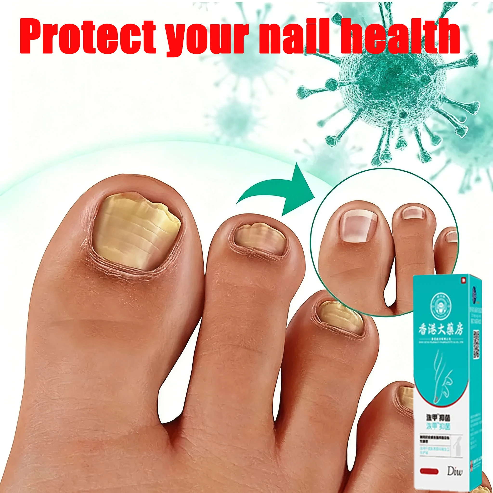 

Скажи прощайте на онихомикоз, безболезненное лечение онихомикоза, средства по уходу за ногтями