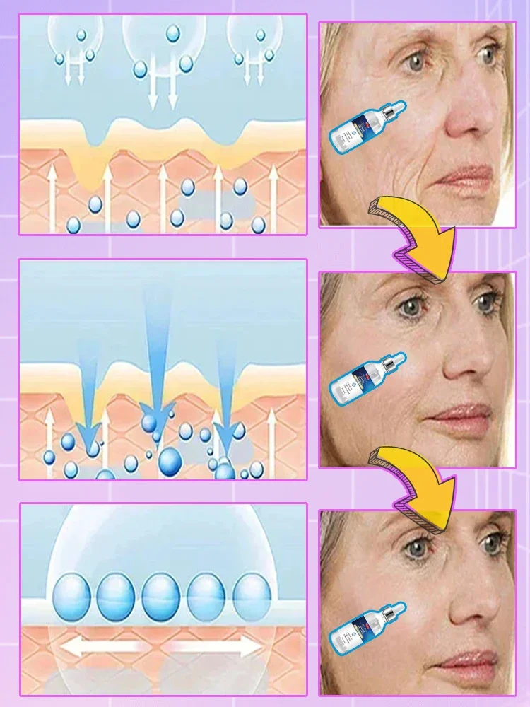 

Разглаживает морщины, 20 лет младшего