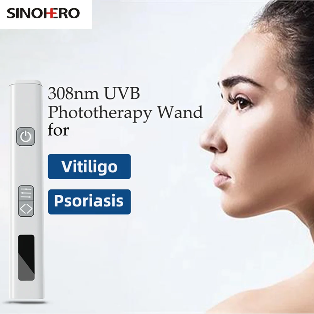 Sinohero 308nm UVB lampa vitiligo měřici zařízení pro vitiligo tratamento a psori-asis léčení