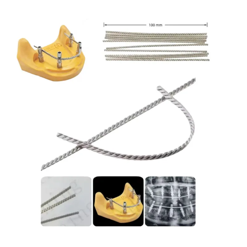 2 /5 pcs Dental Implant Connector Stainless Wire Overdenture MU Wires Strengthener 100mm Full Arch Implant Connecting Bars ﻿