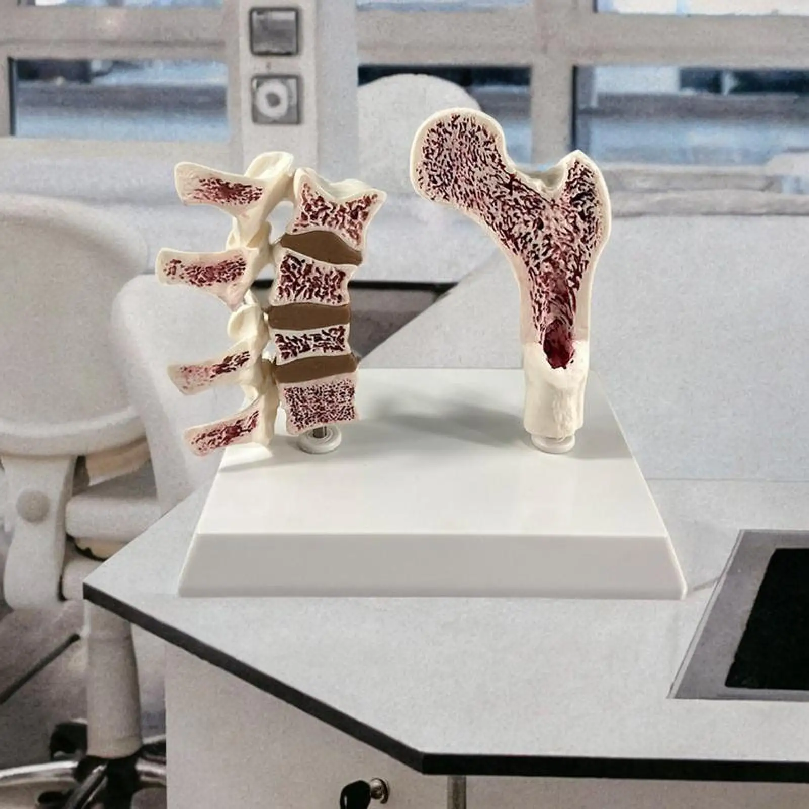 

Human Femur Osteoporosis Anatomy Model, Include Leg Bone and Spine, Sturdy Versatile Learn Props Educational Tool for Home