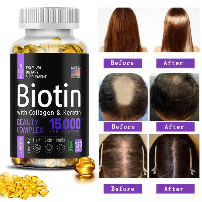 Hydrolyzed Collagen Capsules, Collagen Supplement for Skin Care, Biotin for Skin, Joint, Hair and Nail Care