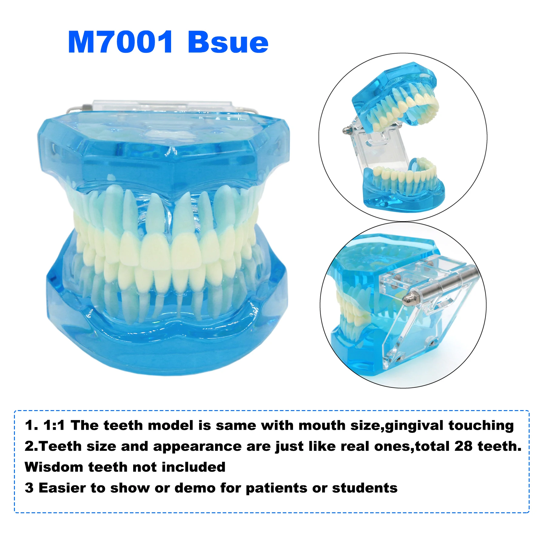 Dental Model Implant/Orthodontic/Periodontitis/Standard Model Dental Teaching Display a variety of dental diseases Model