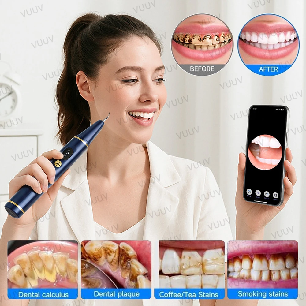 Thumbnail 3 - #33 Ultrasonic Scalers List of Top Picks