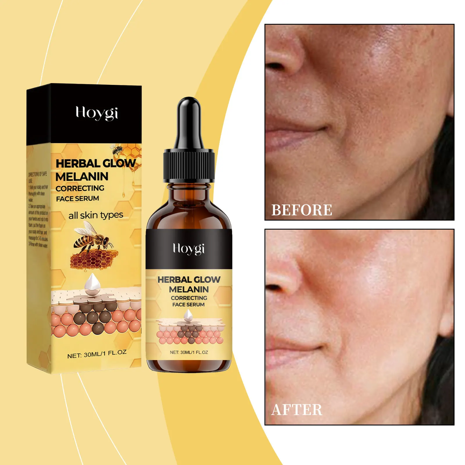 Hoygi Herbal Glow Melanin Correcting Face Serum for Brightening Moisturizing Smooth and Soft Skin All Skin Types